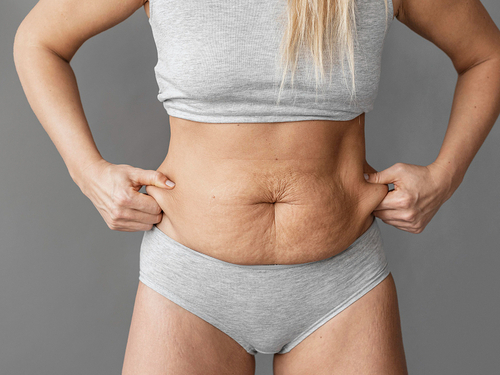 Cómo tratar la diástasis abdominal después del parto, según un experto Cómo tratar la diástasis abdominal después del parto, según un experto